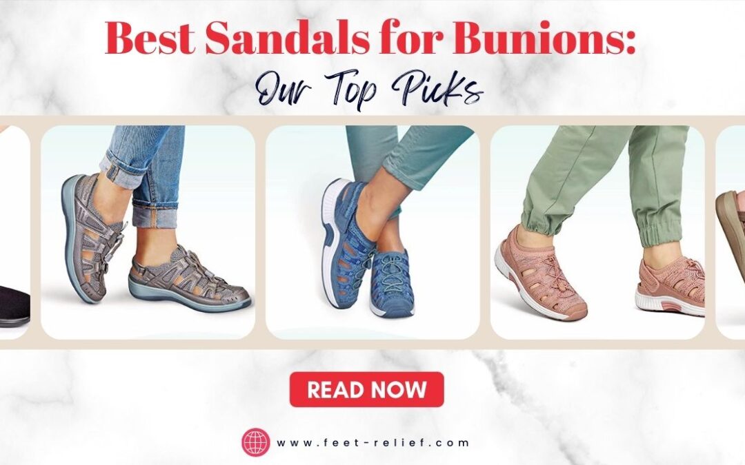 Best Sandals for Bunions: Comfort and Support