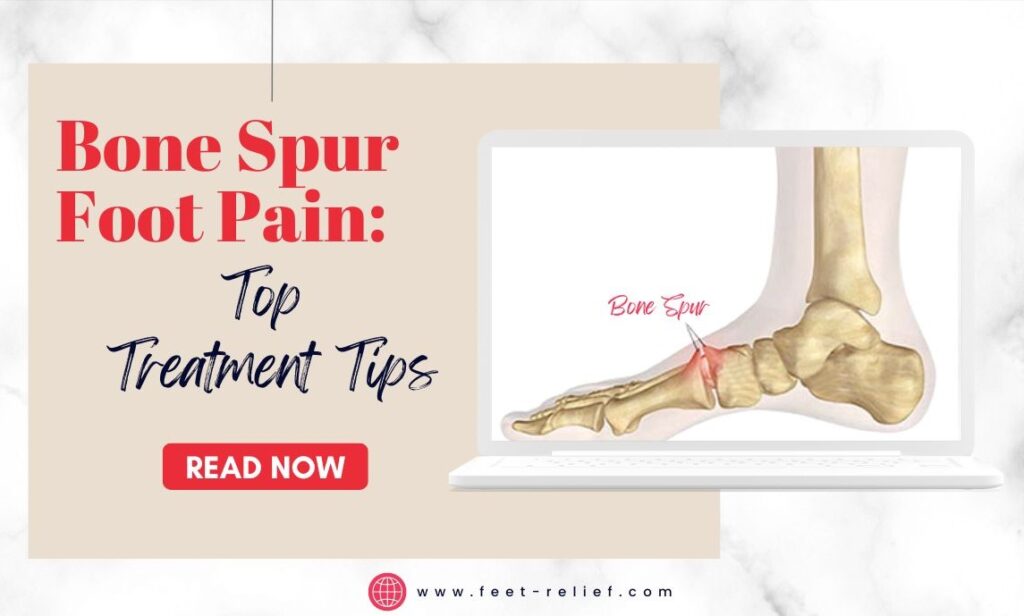 Bone Spur Foot Pain Top Treatment Tips