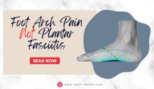 Foot Arch Pain Not Plantar Fasciitis