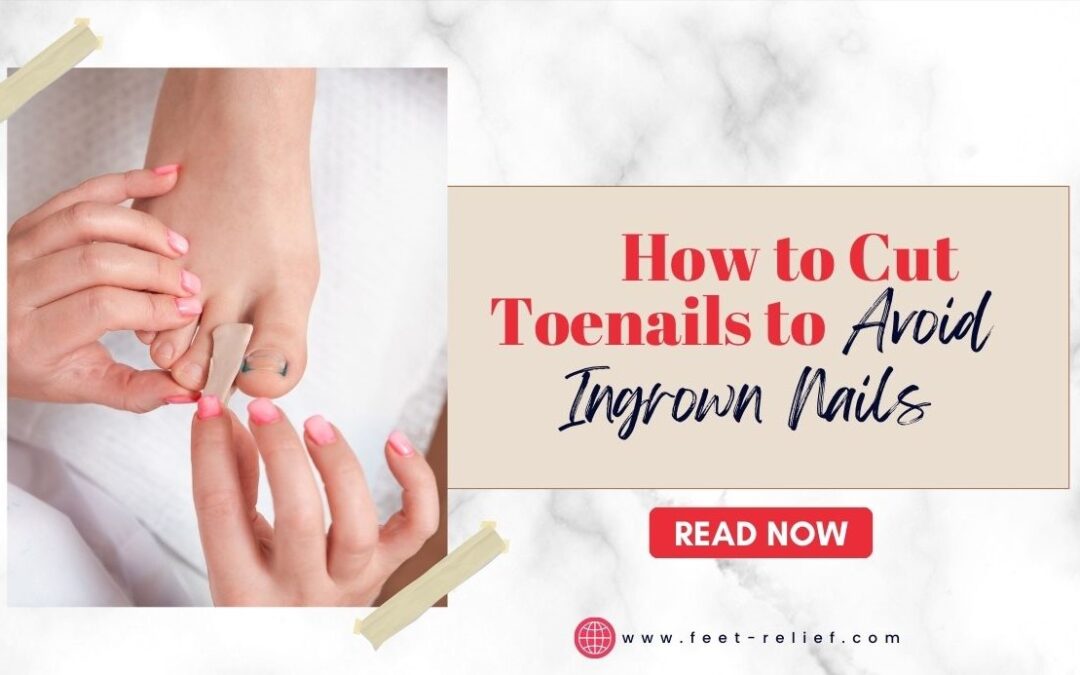 How to Cut Toenails to Avoid Ingrown Nails