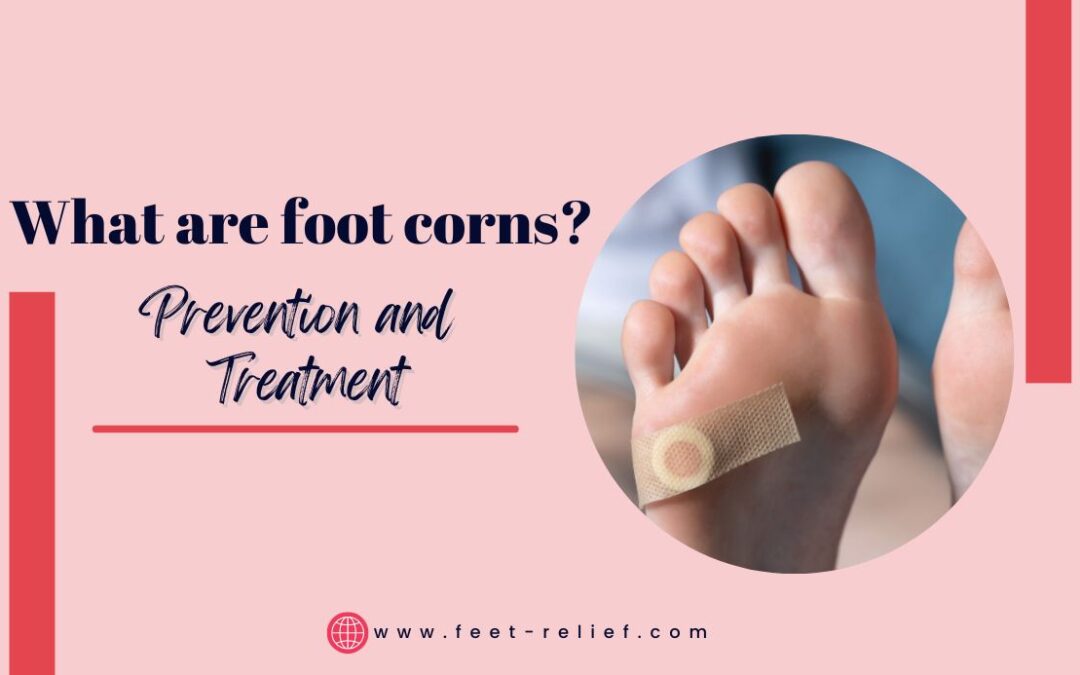 What are foot corns Prevention and Treatment