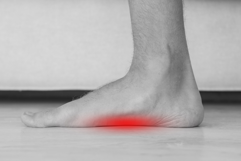 foot arch pain from flat feet