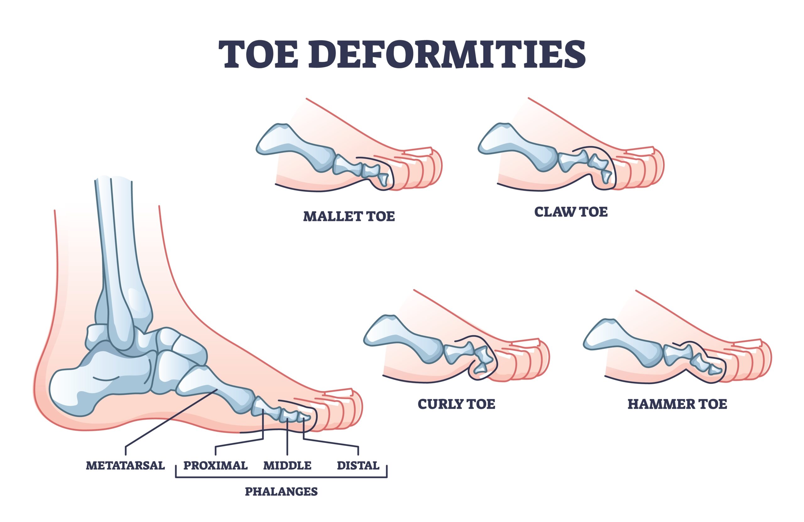 causes of toe pain
