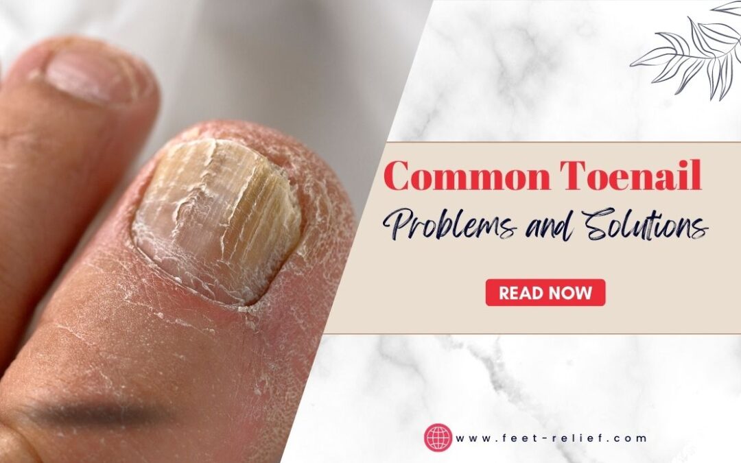 Common Toenail Problems and Solutions Feet Relief