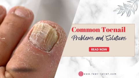Common Toenail Problems and Solutions