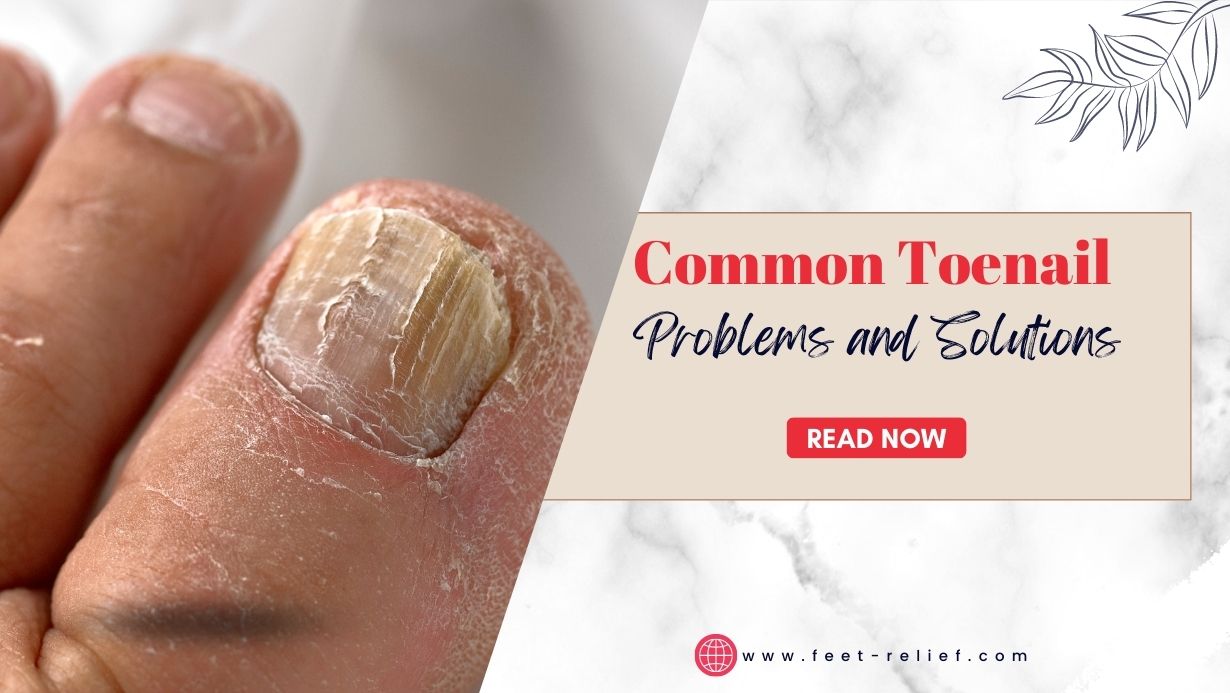 Common Toenail Problems and Solutions - Feet Relief