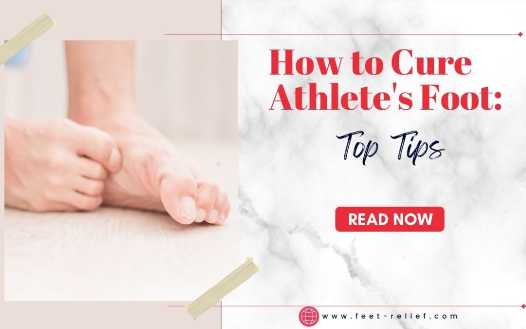 How to Cure Athlete's Foot