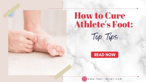 How to Cure Athlete's Foot