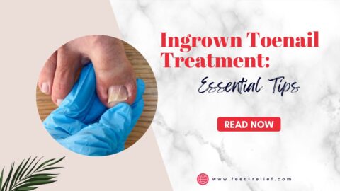 Ingrown Toenail Treatment Essential Tips