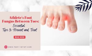 Athlete's Foot Fungus Between Toes: Essential Tips to Prevent and Treat