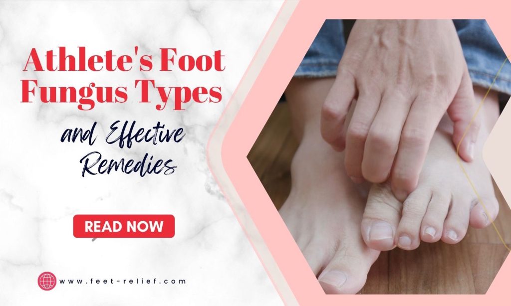 Athlete's Foot Fungus Types and Effective Remedies