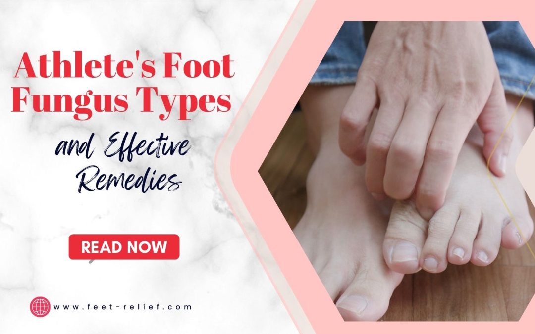 Athlete’s Foot Fungus Types and Effective Remedies
