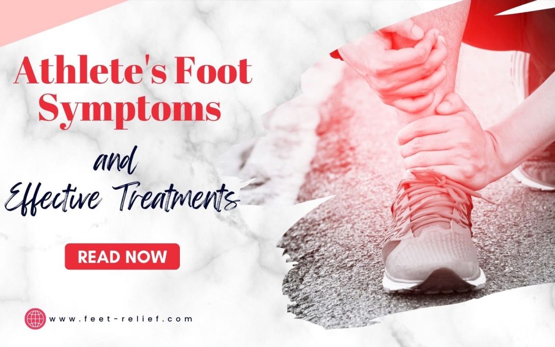 Athlete’s Foot Symptoms and Effective Treatments