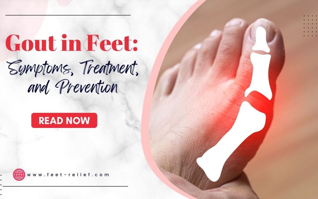 Gout in Feet Symptoms, Treatment, and Prevention Feet Relief