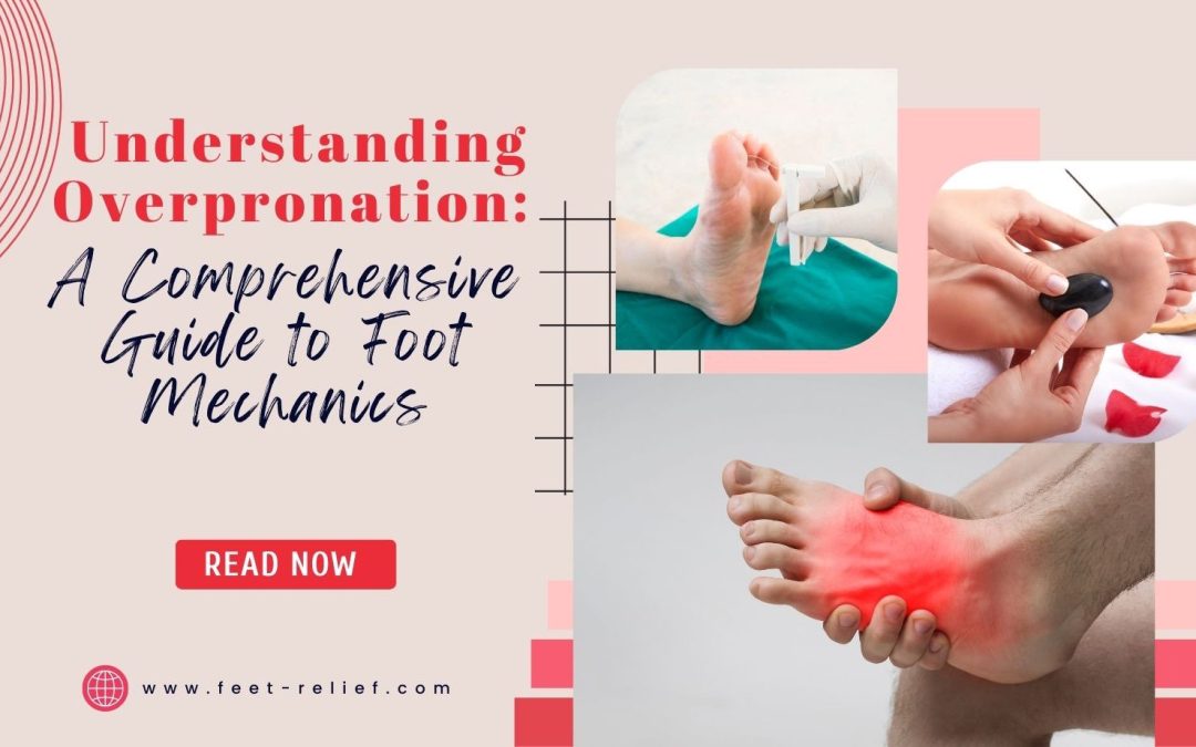 Understanding Overpronation: A Comprehensive Guide to Foot Mechanics