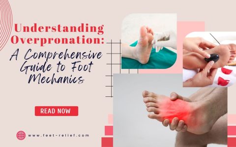 Understanding Overpronation: A Comprehensive Guide to Foot Mechanics