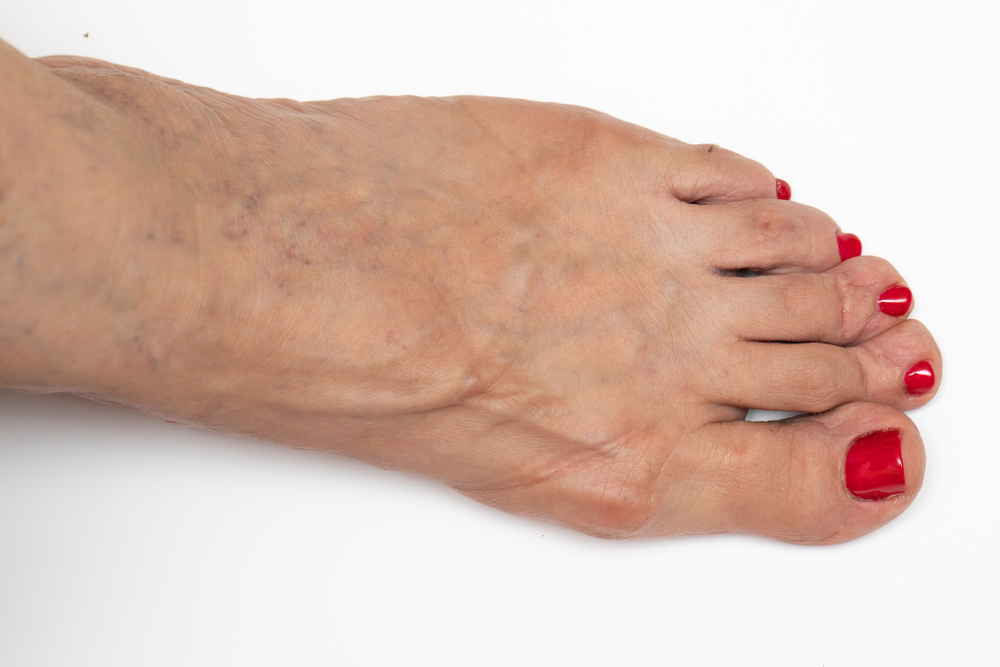 foot massager for arthritis pain