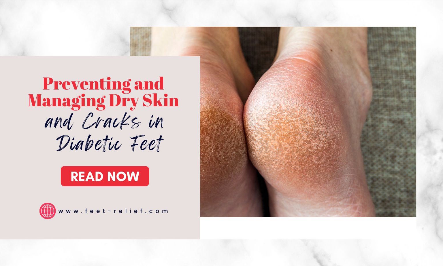 Preventing And Managing Dry Skin And Cracks In Diabetic Feet Feet Relief preventing-and-managing-dry-skin-and-cracks-in-diabetic-feet-feet-relief