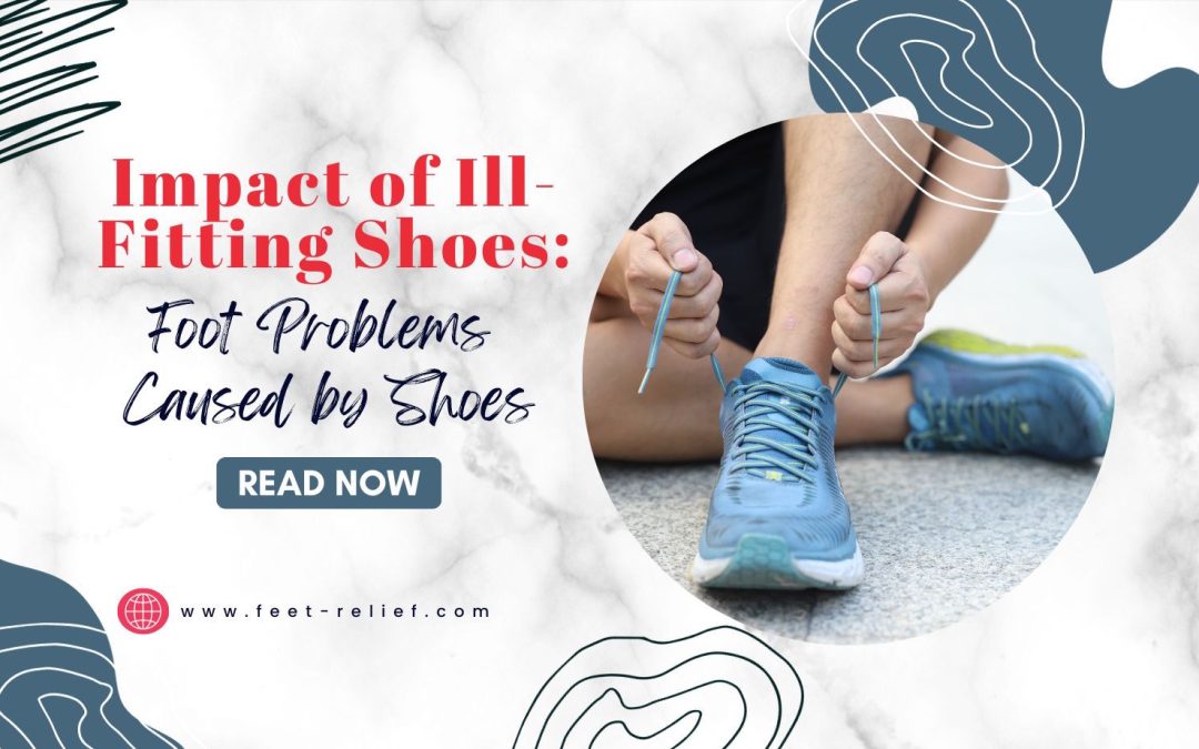 Impact of Ill-Fitting Shoes: Foot Problems Caused by Shoes