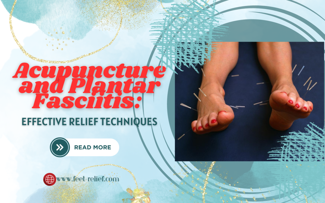 Acupuncture and Plantar Fasciitis: Effective Relief Techniques