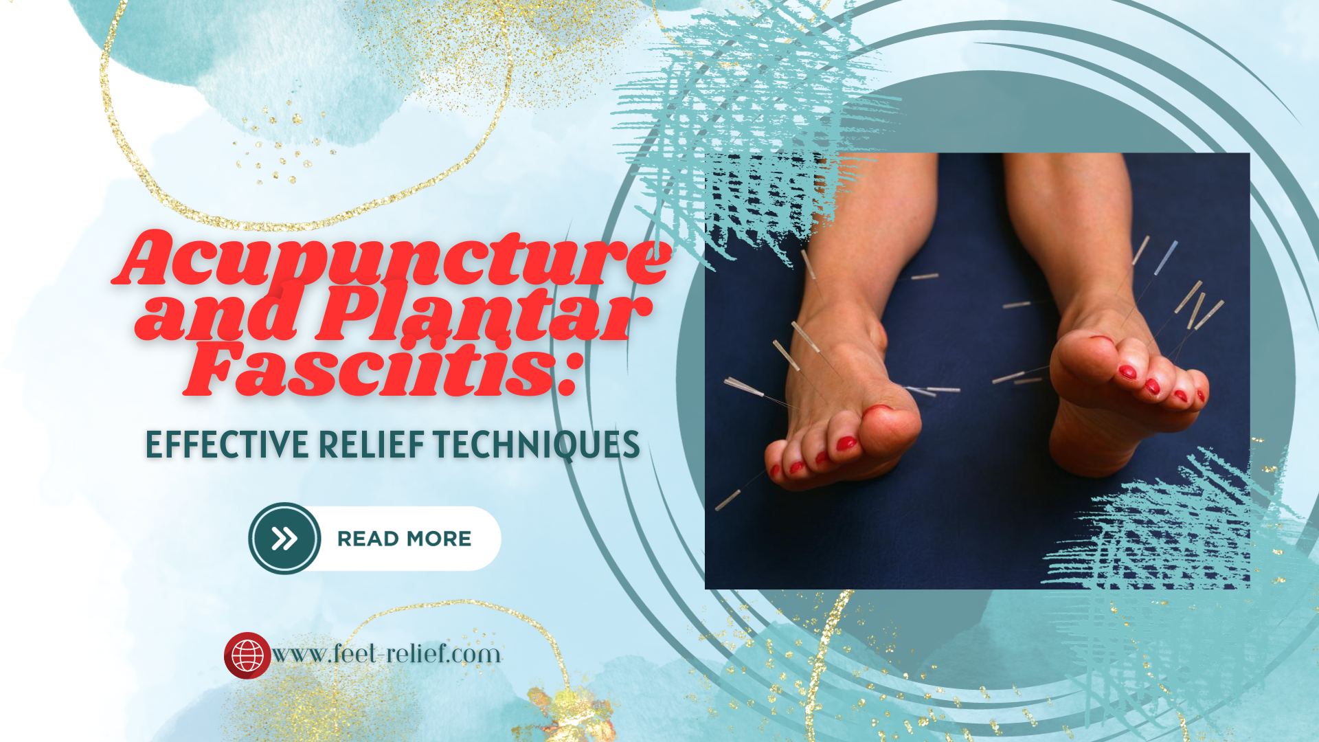 Acupuncture And Plantar Fasciitis Effective Relief Techniques Feet