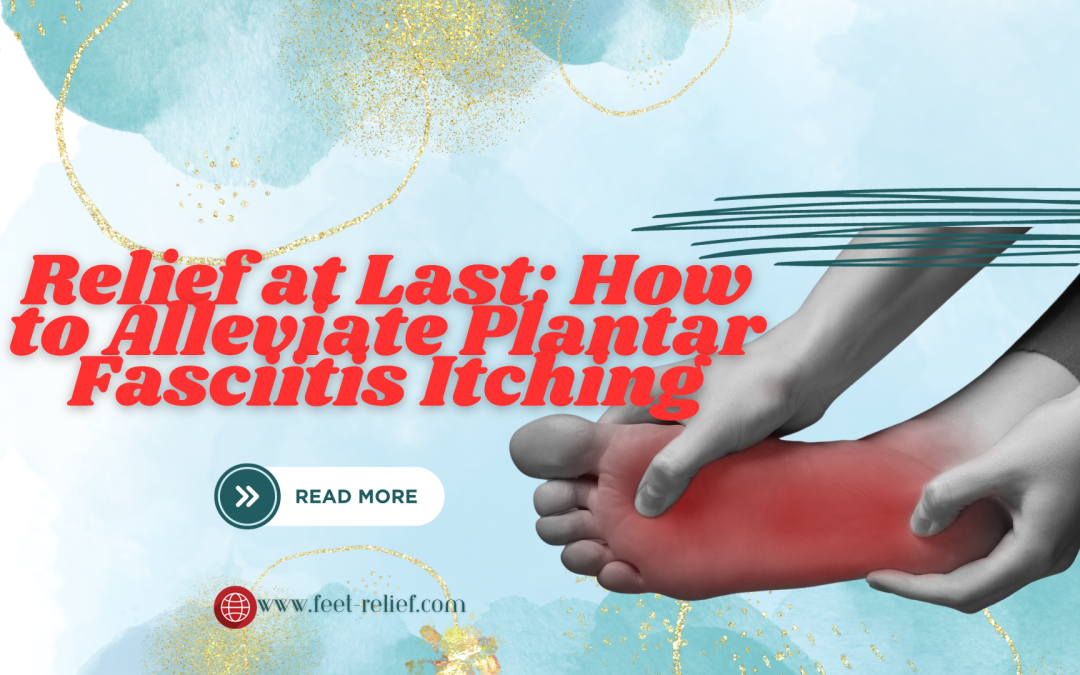 Relief at Last: How to Alleviate Plantar Fasciitis Itching