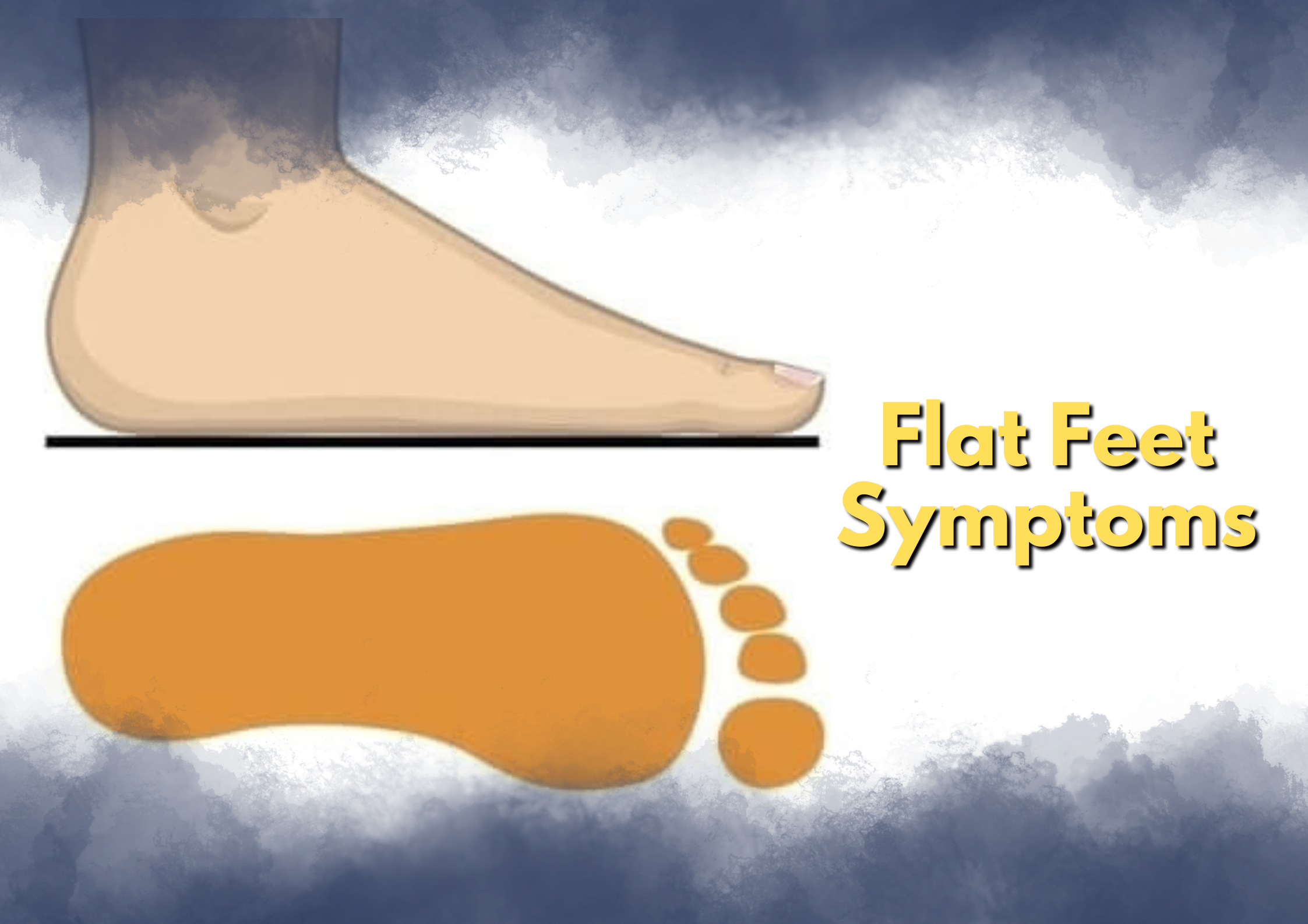 Managing Knee Pain From Flat Feet Feet Relief
