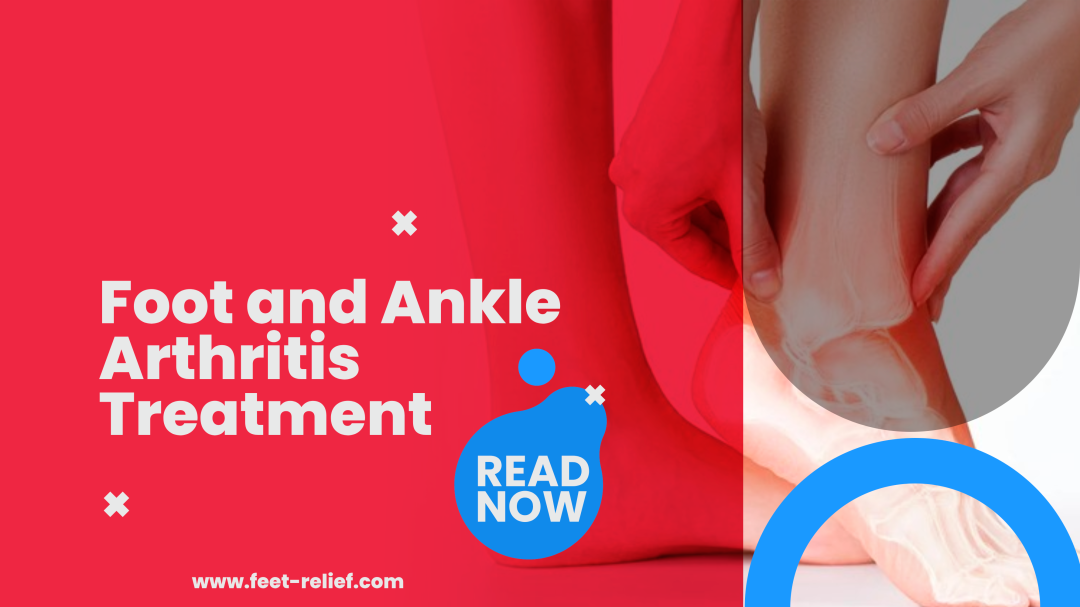 Foot and Ankle Arthritis Treatment