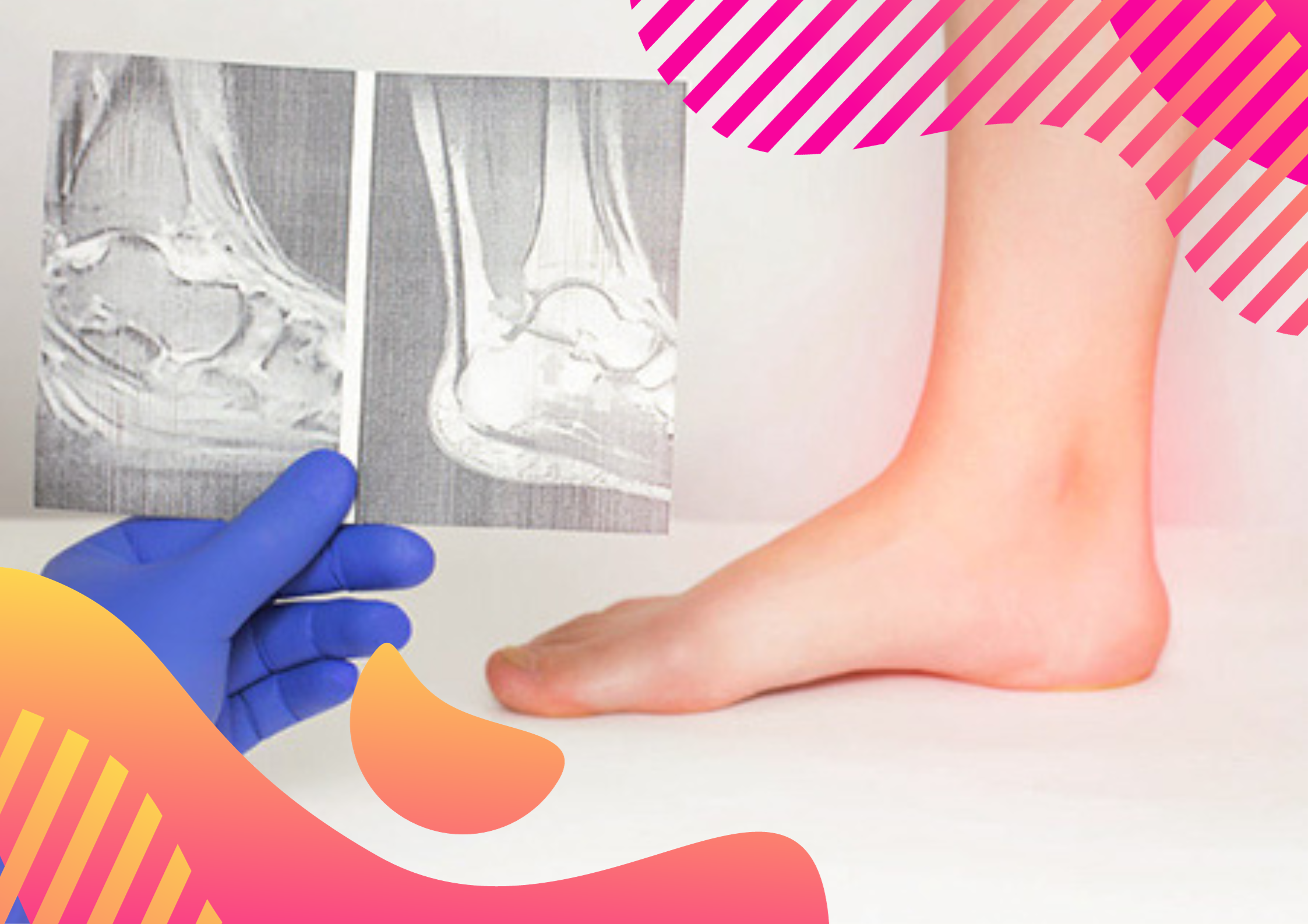 Spotting the Signs and Getting Diagnosed with Ankle Arthritis