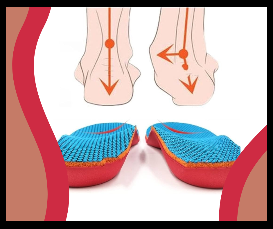 Flat Feet Injuries and Complications