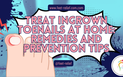 Treat Ingrown Toenails at Home: Remedies and Prevention Tips