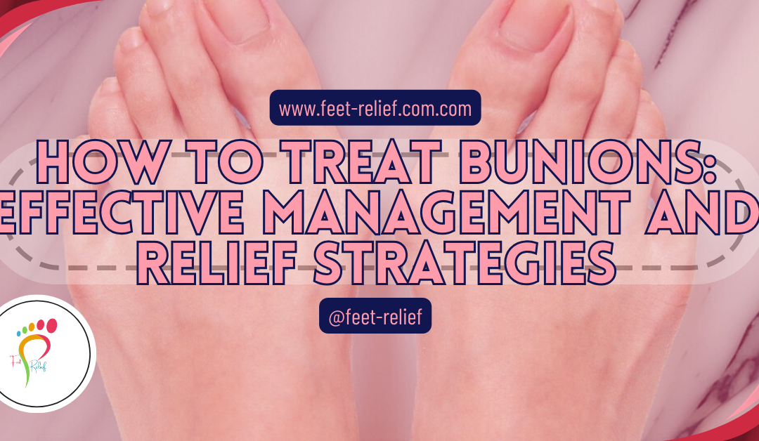 How to Treat Bunions: Effective Management and Relief Strategies