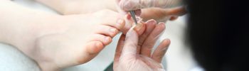 treating ingrown toenails at home