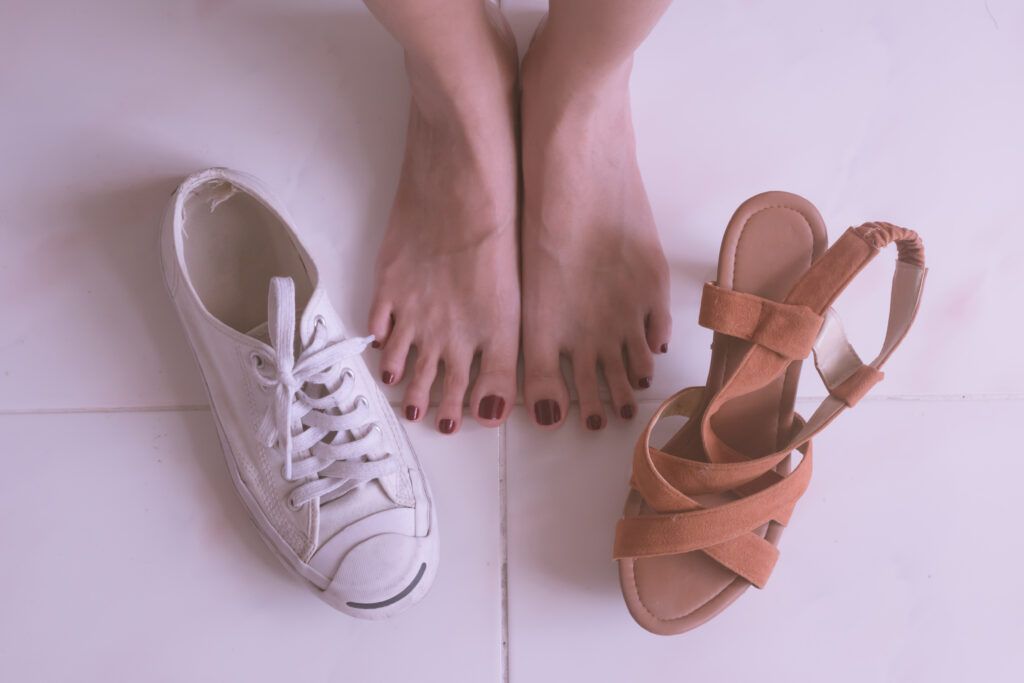 Treating Bunions