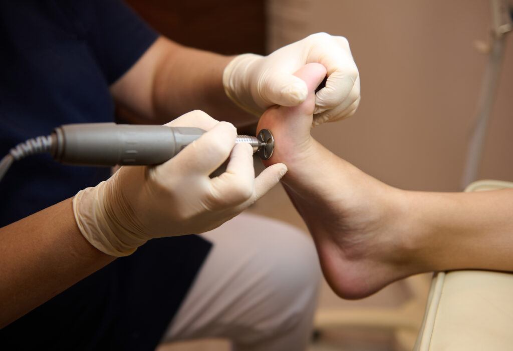 Preventing foot pain from prolonged standing
