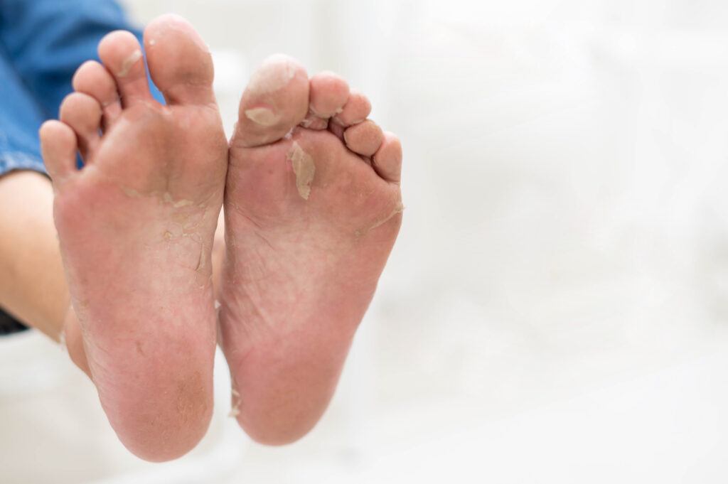Preventing foot pain from prolonged standing