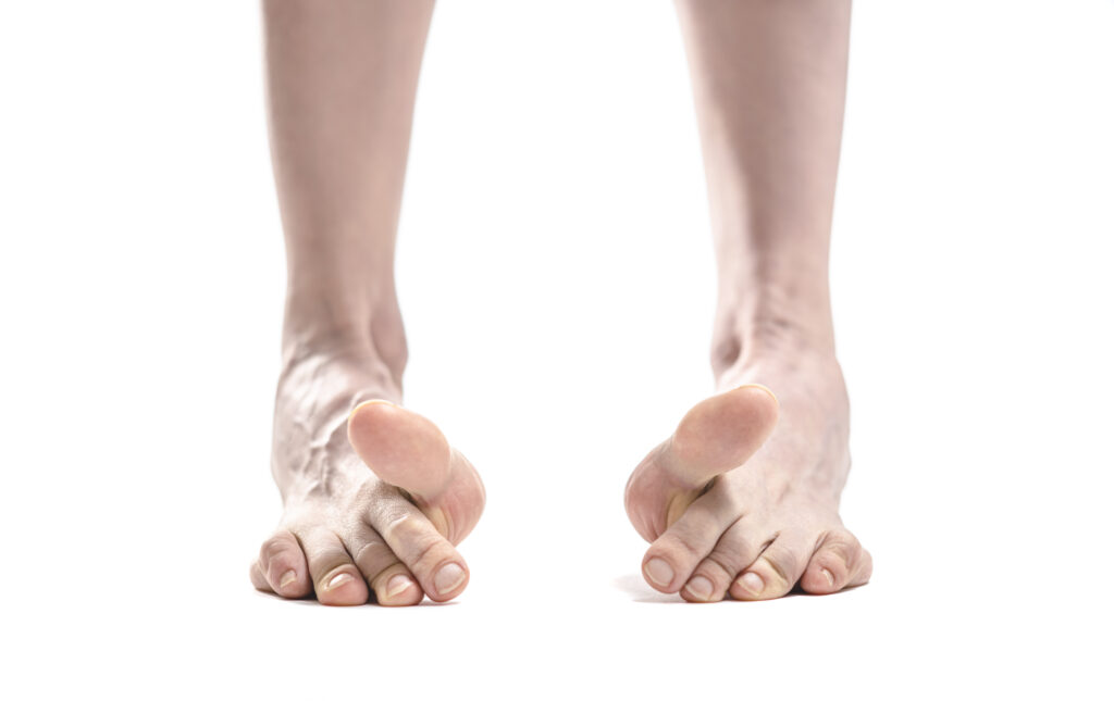 benefits of toe yoga